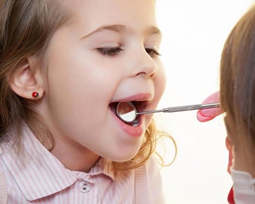 Предотвратяване на кариес с флуорид